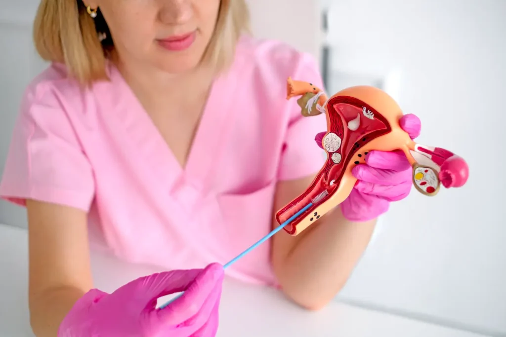 Cirugía de miomectomía para extirpar un mioma uterino conservando el útero
