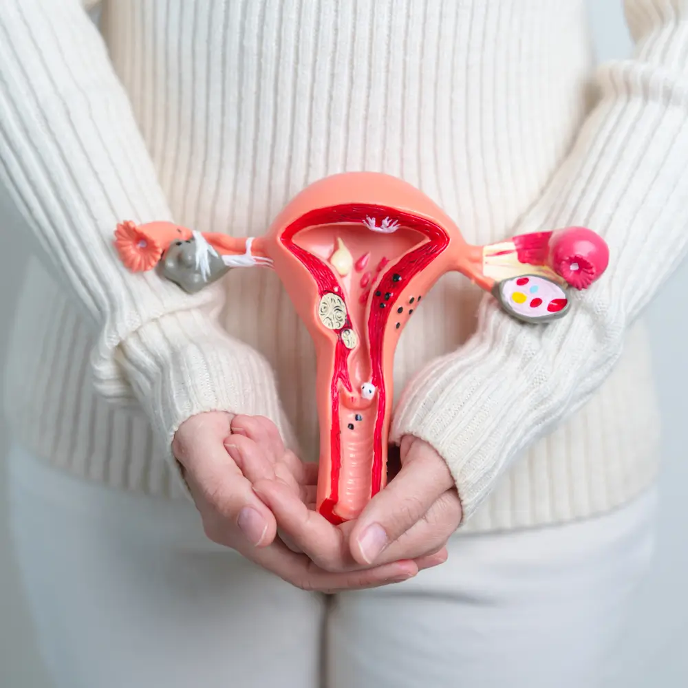 Miomas uterinos: La mayoría de las mujeres no presentan síntomas