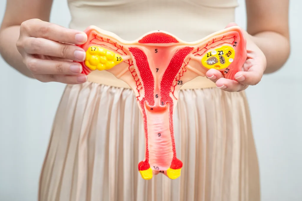 Imagen ilustrativa del útero mostrando qué es la endometriosis