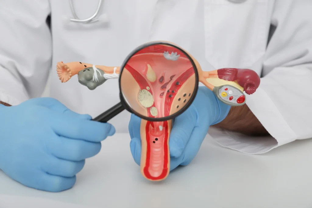 tratamiento para infección vaginal - Clínica Femme